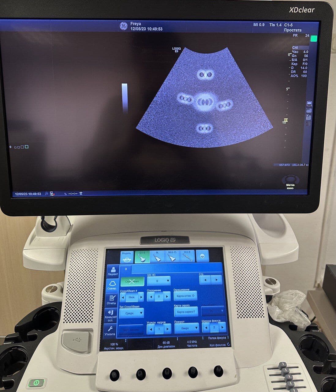 GE Healthcare Logiq E9 R6 (XDClear 2.0) Ultrasound System