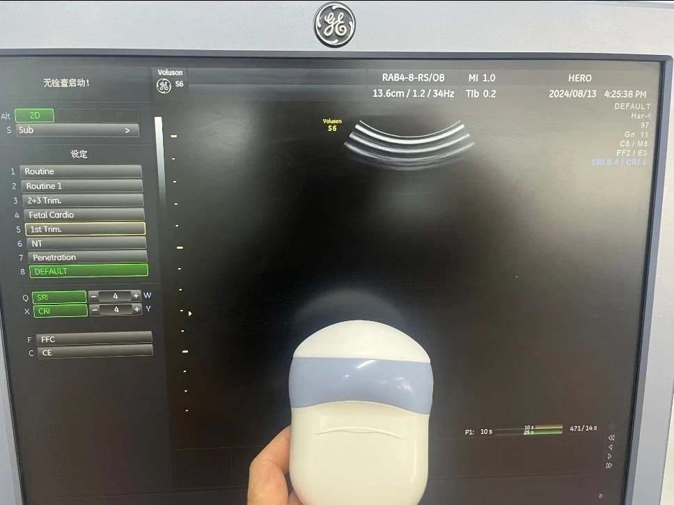 GE RAB4-8-RS 4D Volume Ultrasound Probe for Voluson E8, E10, S8 & Women's Health Imaging Systems – OB/GYN, Fetal and Abdominal Applications