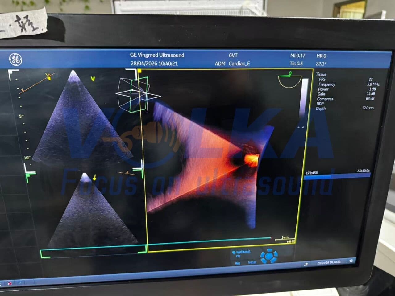 GE Healthcare 6VT-D 3D/4D TEE Cardiac Ultrasound Probe