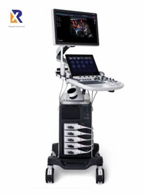 SonoScape P60 Cardiac and Vascular Ultrasound System