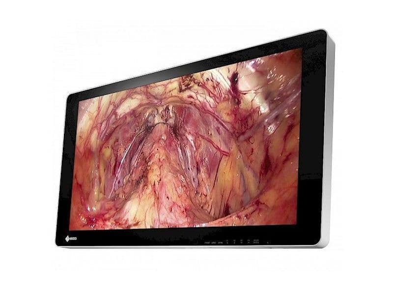 4K 3D Surgical Monitor by EIZO — EX3141-3D