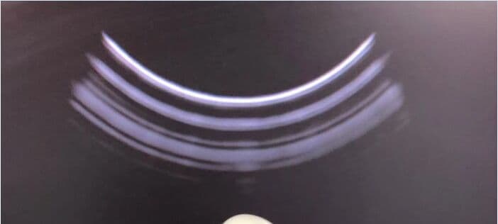 Toshiba PVT-781VT Endocavity Ultrasound Probe for Aplio Systems