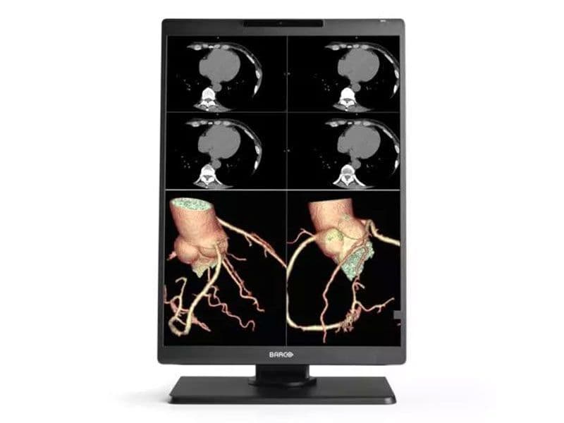 Barco MDNC-2521 Nio Color 2MP Diagnostic Monitor