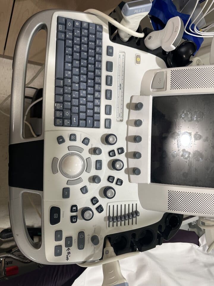 GE Logiq E9 Shared Service Color Doppler Ultrasound System