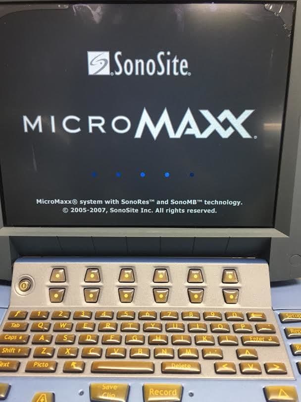 Sonosite MicroMaxx Portable Ultrasound System