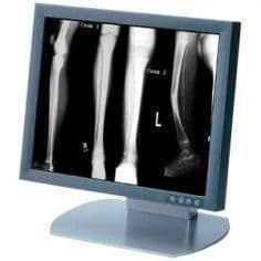 GE SMD18102G 18-inch Replacement Medical Display Monitor