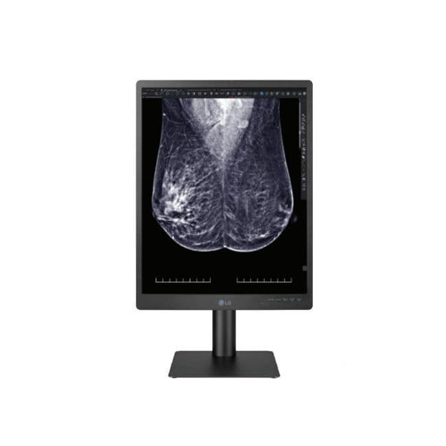 LG 21HQ613D-B 5MP Diagnostic Radiology Monitor