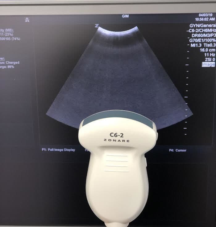 ZONARE C6-2 Convex Ultrasound Transducer Probe