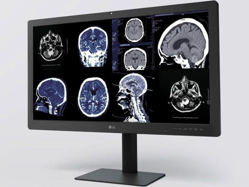 Diagnostic Radiology 8MP Monitor — LG 32HQ713D-B