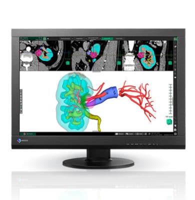 Diagnostic Imaging Display Monitor — EIZO RadiForce MX242W-BK