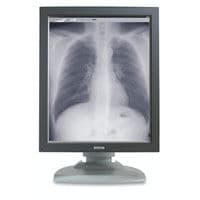 5MP Diagnostic Display Monitor — Barco MFGD5421