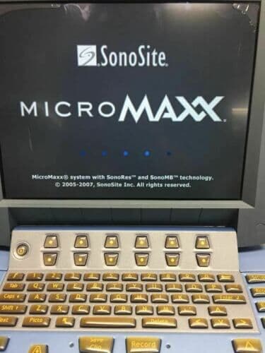 Sonosite MicroMaxx Portable Ultrasound System