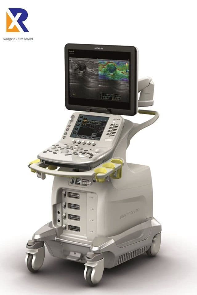 Hitachi Arietta V70 High-Performance Ultrasound System