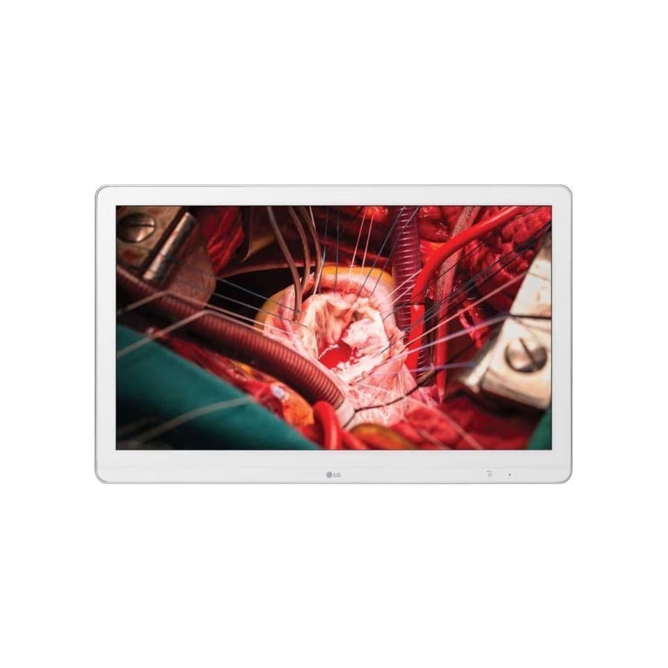 LG 27HK510S-W 27-inch FHD Surgical Monitor