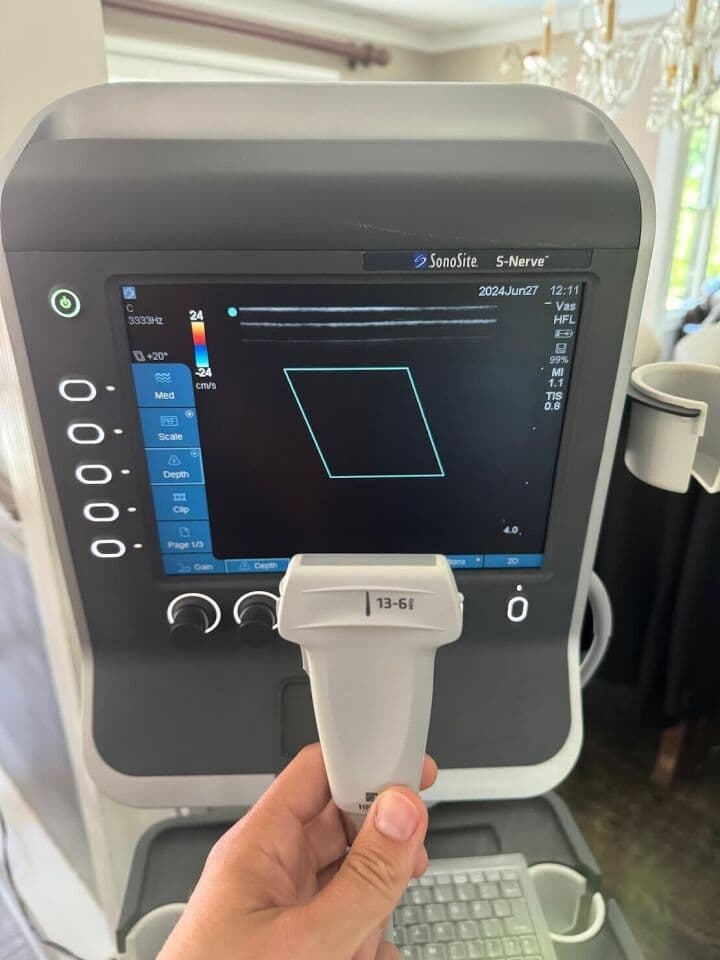 Sonosite S-Nerve Ultrasound System with Cart and L38x Vascular Probe