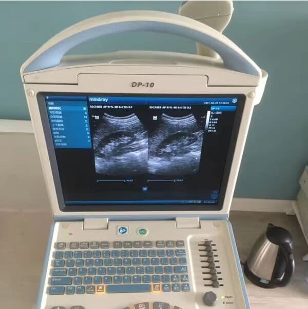 Mindray DP-10 Portable B/W Ultrasound Scanner with Convex Probe