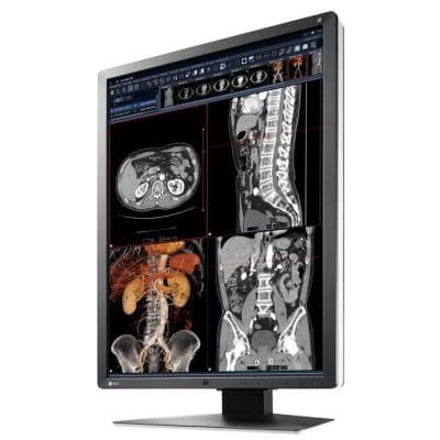 RadiForce RX250 21-Inch Color Diagnostic Monitor by EIZO