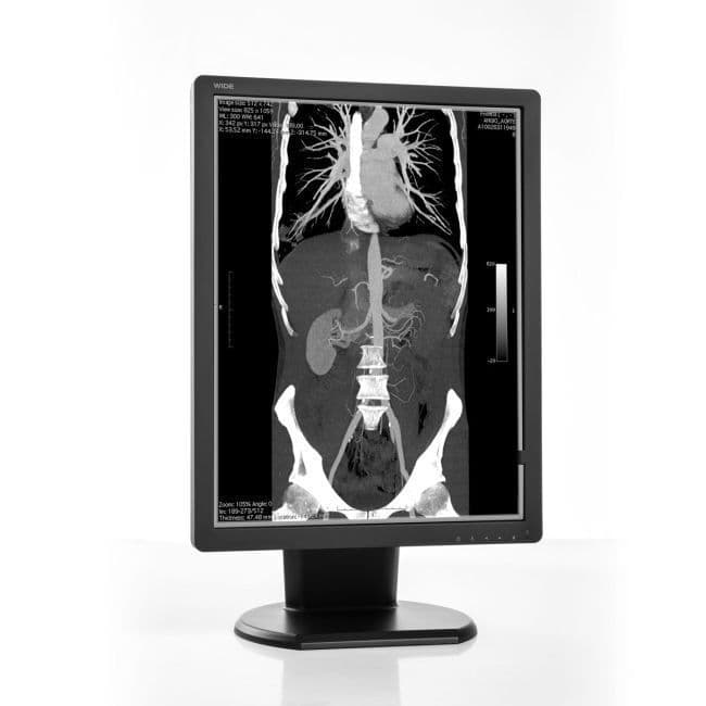 Diagnostic Radiology Display — WIDE MX30N 3MP Monochrome Monitor