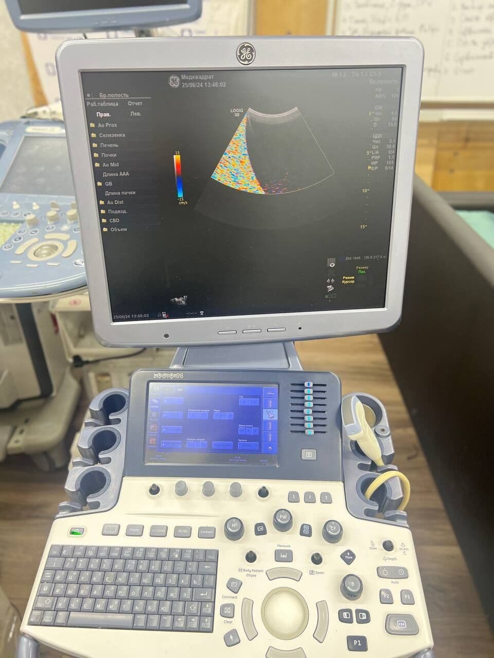 GE Healthcare Logiq S8 R2 Ultrasound System