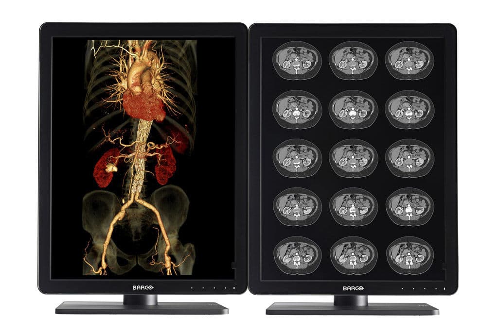 Barco MDNC-3421 3MP Color Diagnostic Display Monitor
