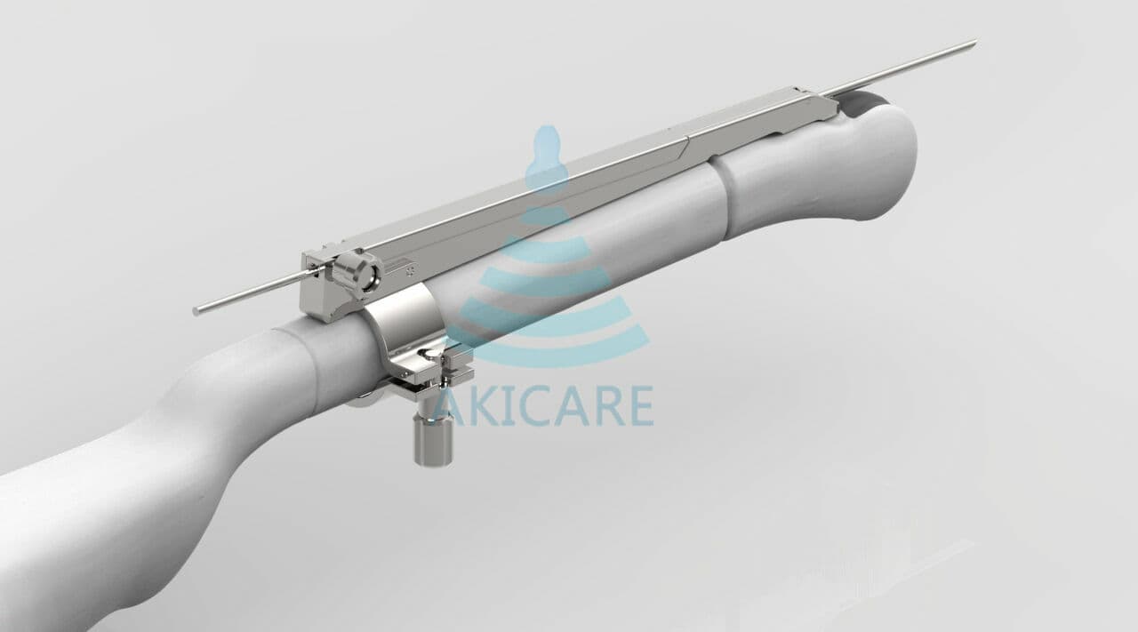 Esaote EC123/EC1123 Ultrasound Probe Biopsy Guide Kit