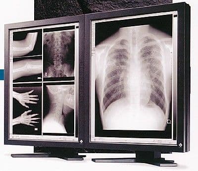 Radiology Display Monitor for Diagnostic Imaging — Eizo RadiForce FC-2091 (OFT02947SQ)