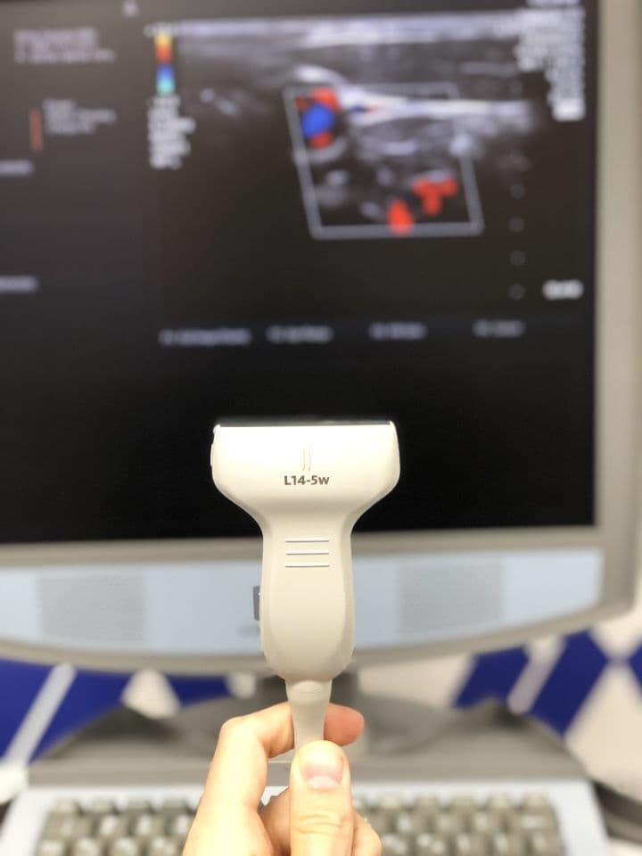ZONARE L14-5W Linear Ultrasound Transducer