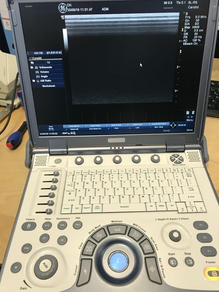 Portable GE Logiq e Ultrasound System for OB/GYN and Vascular Imaging
