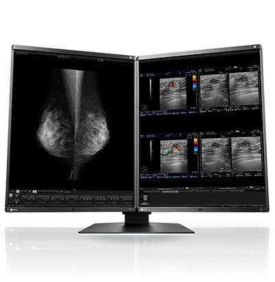 Diagnostic Display Monitor by EIZO (RX560)