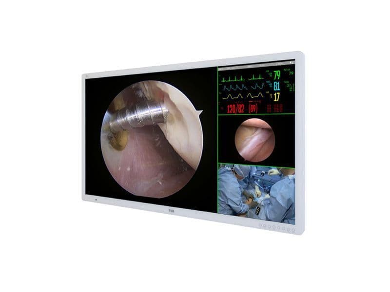 55-inch 4K Surgical Monitor from Foreseeson — FM-A5504DS