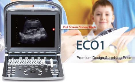 Portable B/W Ultrasound System — Chison ECO1
