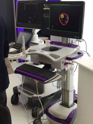 Philips EPIQ 7G OB/GYN and Vascular Ultrasound System
