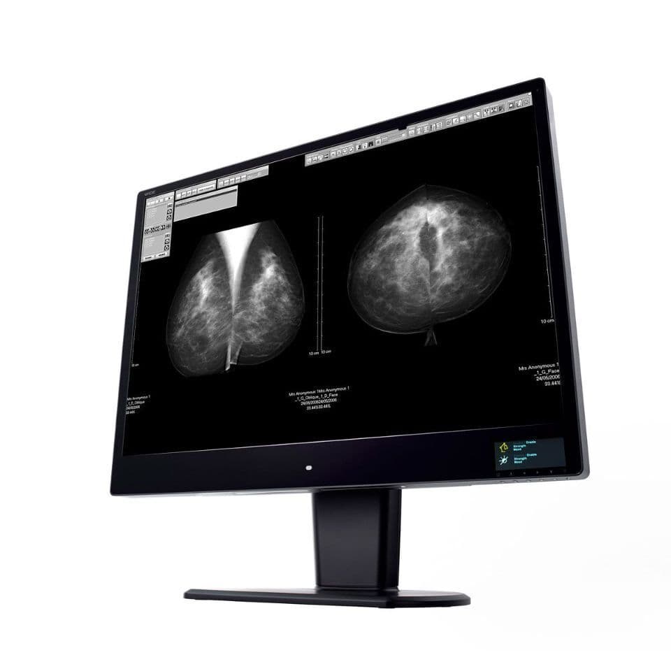 Diagnostic Radiology Display Monitor — WIDE CW120N