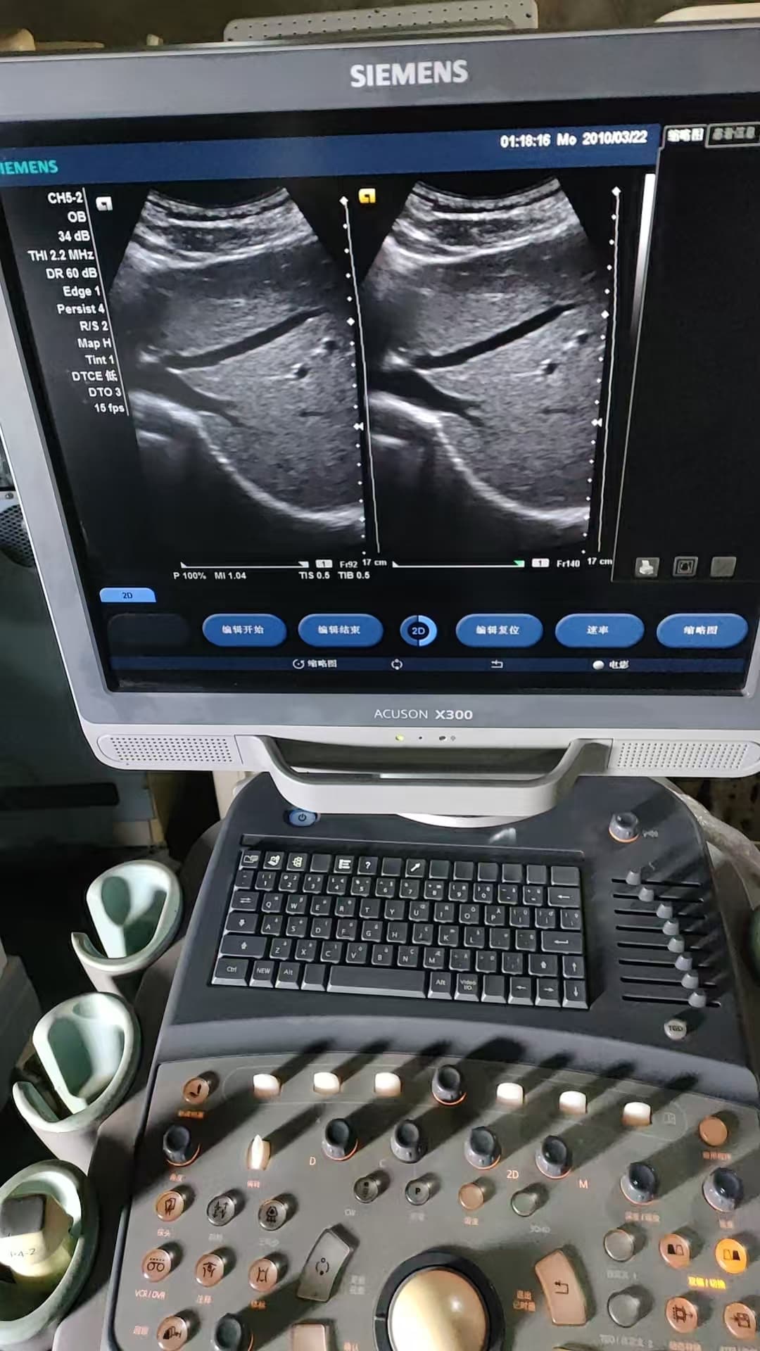 Siemens X300 | ACUSON X300 Ultrasound | Used Color Doppler Diagnostic Console | Siemens Ultrasound Without Probes | Shared Service Imaging Gantry
