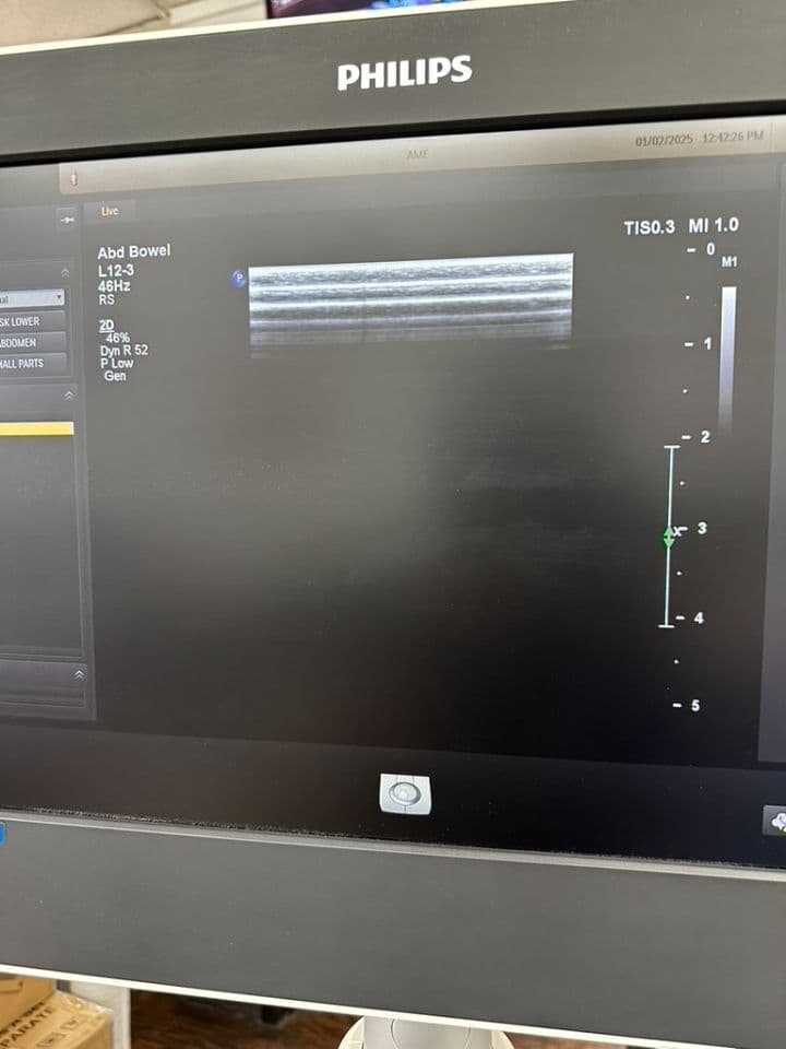 Philips L12-3 Linear Ultrasound Transducer