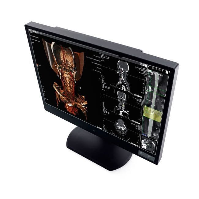 6MP Diagnostic Radiology Display Monitor — WIDE CW60N