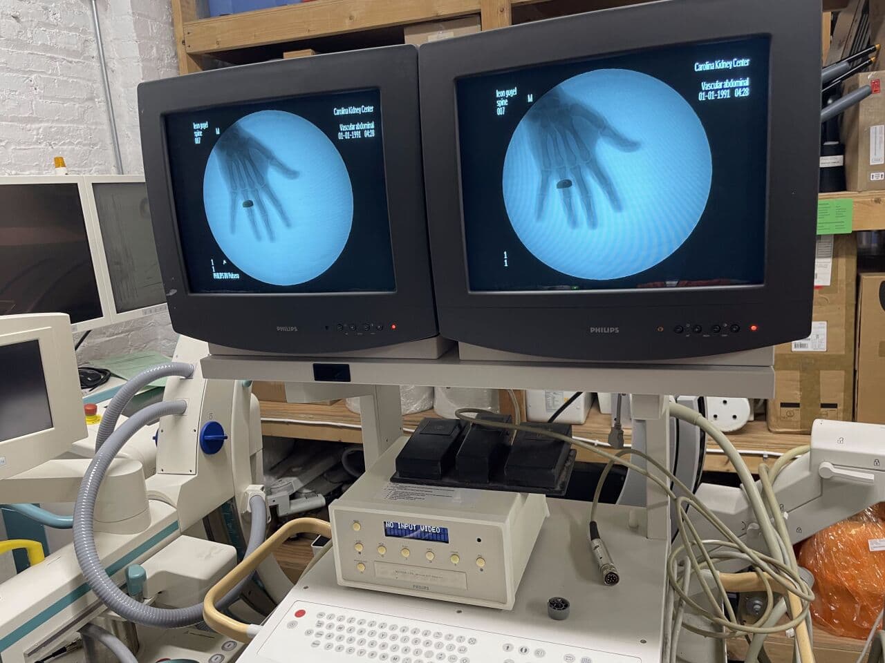 Philips BV Pulsera Digital Mobile C-Arm System