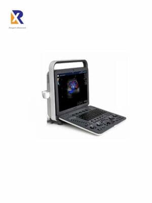 SonoScape S8 Portable Color Doppler Ultrasound System
