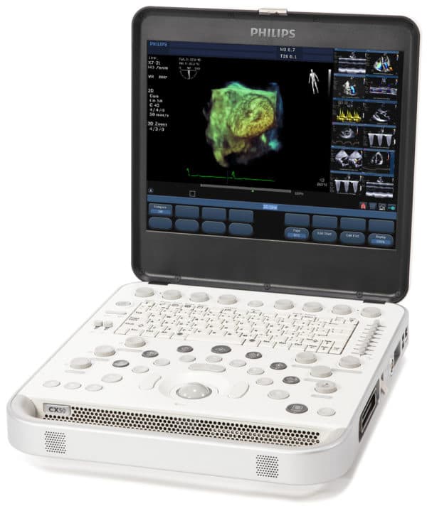 Philips CX50 Portable Ultrasound System