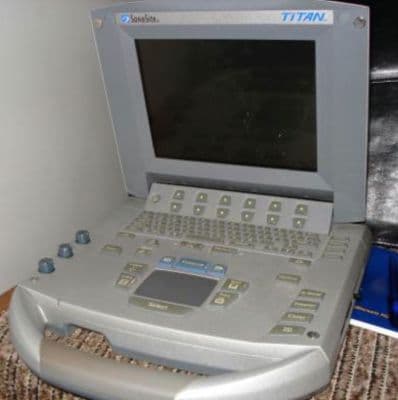 SonoSite Titan Portable Ultrasound System for OB/GYN & Vascular Applications