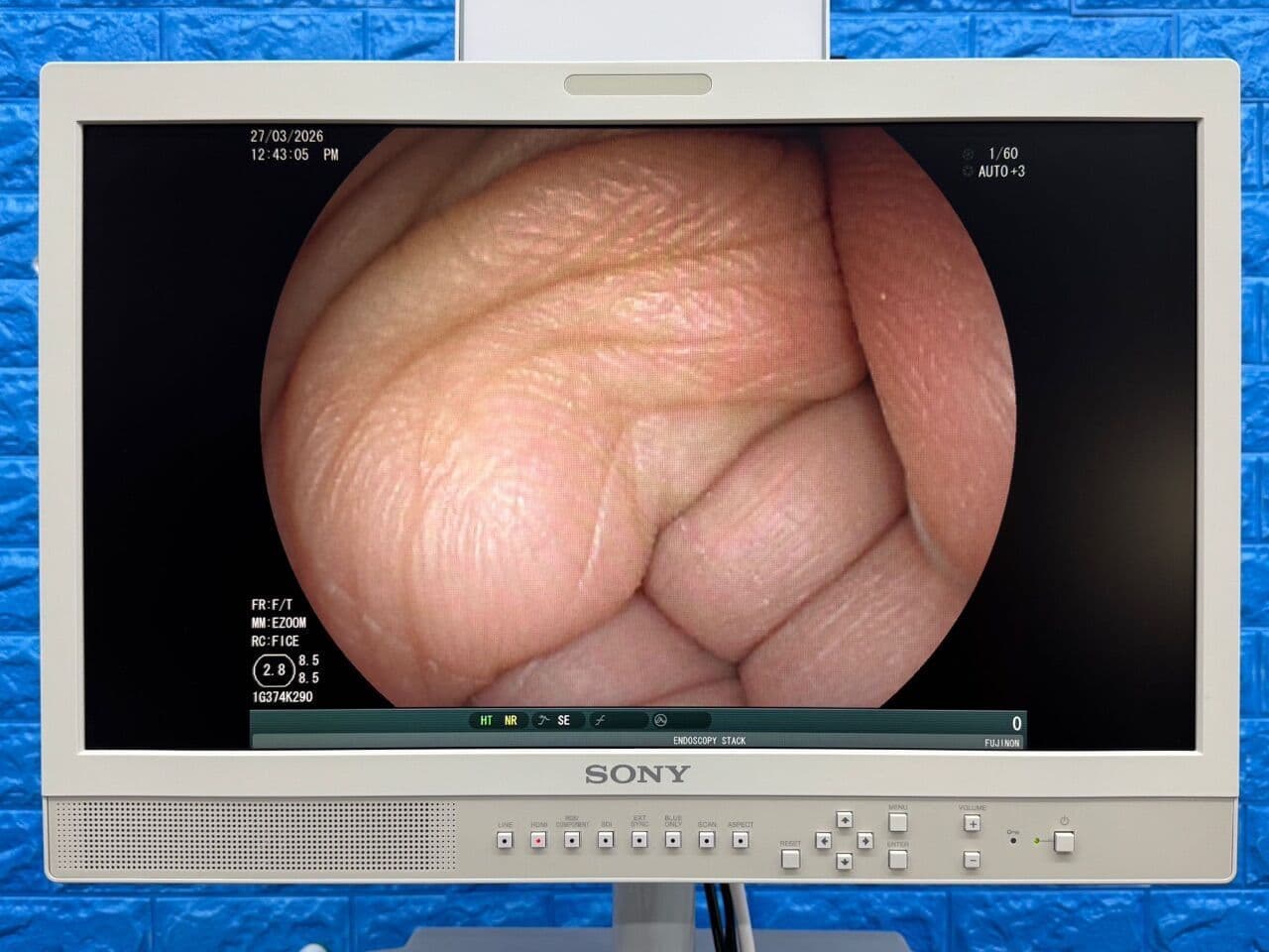 For Sale FUJINON Scope Model: EG-530FP Gastroscope Gastroscope