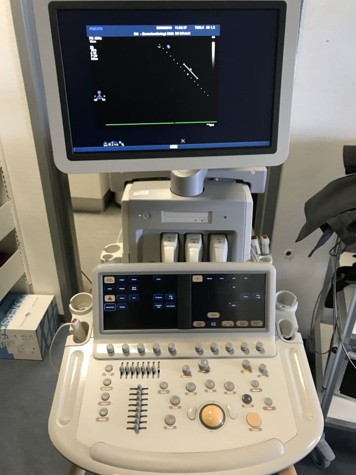 Refurbished Philips iE33 Cardiac Ultrasound System