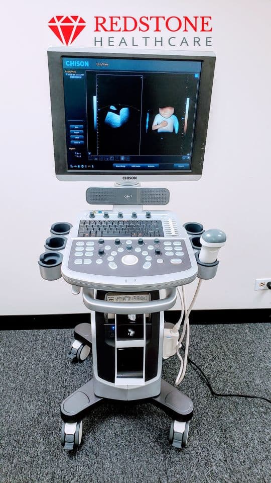 Chison QBit 7 4D Digital Color Doppler Ultrasound System