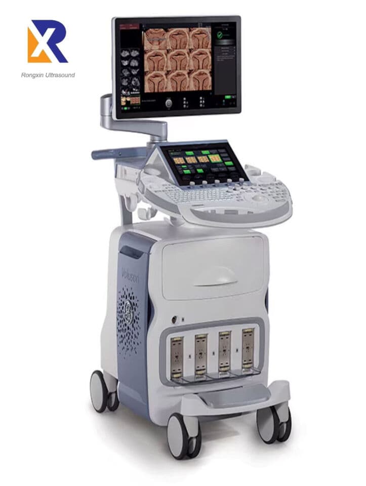 GE Voluson E6 3D/4D Ultrasound System