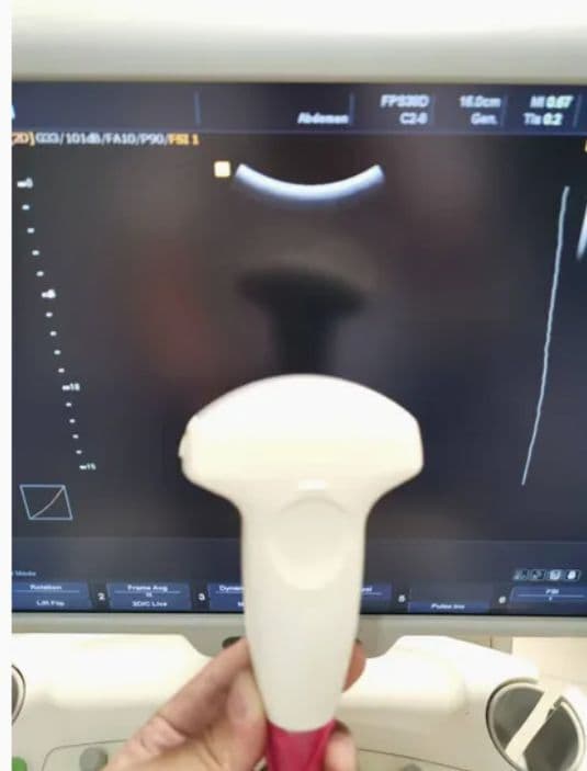Samsung Medison C2-8 Convex Ultrasound Transducer