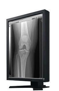 EIZO 2MP RadiForce G22 Diagnostic Display Monitor
