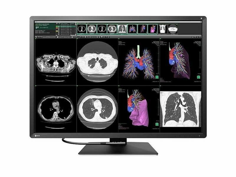 EIZO RadiForce RX1270 12MP Color PACS Diagnostic Monitor