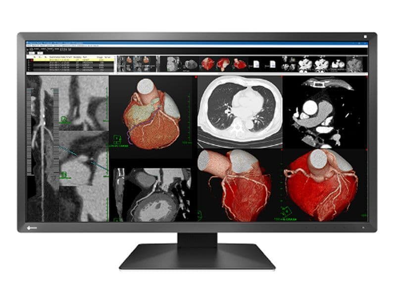 8MP Clinical Review EIZO MX317W Monitor with USB-C Docking