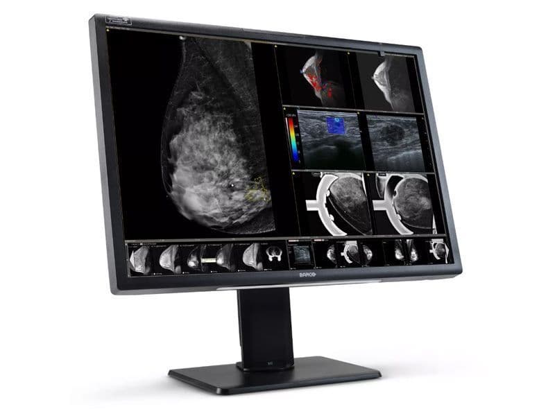 12MP Nio Fusion Radiology Display — Barco MDNC-12130 Monitor