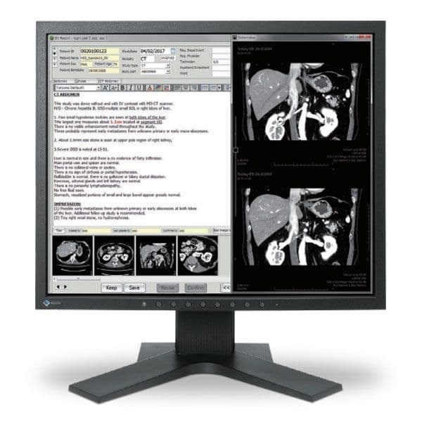 RadiForce MX194-BK Diagnostic Display Monitor from EIZO
